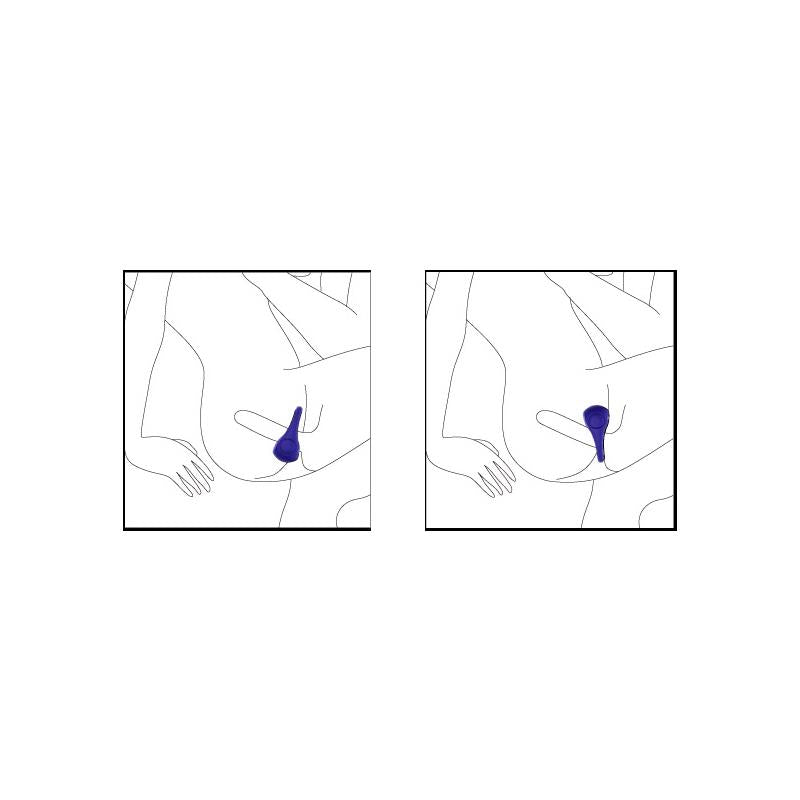 NALONE - ANILLO VIBRADOR PING FUCHSIA