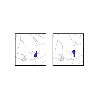 NALONE - ANILLO VIBRADOR PING FUCHSIA